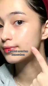 SKINTIFIC Symwhite 377 Dark Spot Eraser Serum 20 ml | mencerahkan noda hitam pada kulit | mengunci kelembaban kulit