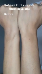 Precious Skin Thailand Alpha Arbutin 2 In 1 AHA Serum Booster Set / Lotion / Serum / AHA Mimi / AHA Whitening