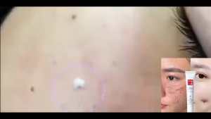 Krim penghilang flek hitam Krim Dark spot removal cream 20g Niacinamide Whitening Cream