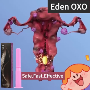 Eden【OXO】Vaginal Tightening Gel Shrink Vagine Tightening Lubricant Orgasmi Gel Drops Women Gel Enhancer Massage Oil Adults Anti-inflammatory/soothing/promoting cell repair/cell regeneration.