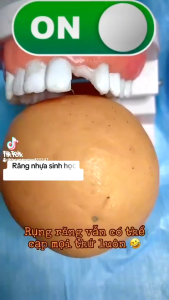 Vật liệu nha khoa Dụng Cụ Sửa Chữa Răng Và Khoảng Cách Răng Giả Tiện Dụng