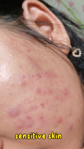 REGLOW Moisturizer Gel Pelembab Wajah 30 ml untuk Memperbaiki Skin Barrier yang Rusak By Dokter Shindy Putri