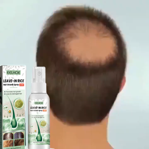 Serum Penumbuh Rambut Botak & Rontok Rusak 100ml: Solusi Perawatan Rambut Rontok Dewasa