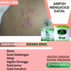 Sabun Bidara Sirih Herbal (sabun spesialis gatal gatal)