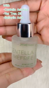 20MeFree - Centella Acne Serum - Perawatan Kulit Berjerawat dan Membantu Mengontrol Minyak Berlebih