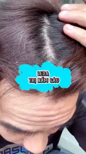 Dầu gội hỗ trợ giảm gàu Leva Anti Dandruff 450ml