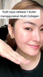 [BUY 1GET 1] MULTI COLLAGEN 5X PREMIUM Collagen Supplement Beauty Whitening Anti Aging Smooth Skin