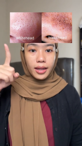 Reluvie Brightening Barrier Serum - Instan Glowing & Perbaiki Skin Barrier - 10ml/20ml