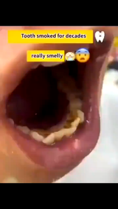 Probiotic Toothpaste teeth whitening removes plaque and tartar 290g fresh breath prevents tooth decay inhibits bacteria and restores damaged gums