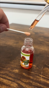 Kasoy Oil Warts Remover Natural Mole Remover 15 mL Warts are contagious remove it naturally w/out surgery this facial serum proven safe & effective. It effectively removes skin tag moles warts (kulugo) milia (syringoma) & calluses (kalyo).