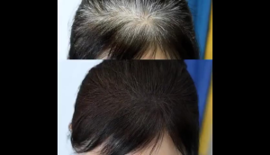 何首乌育发精华Polygonum multiflorum hair nourishing essence spray pure Chinese herbal medicine added 100ml growth hair black hair healthy and effective