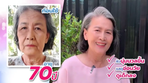 Barcony โสมเกาหลี ครีมโสม 3 สี เกาหลี ลดเรือนริ้วรอย หน้าอิ่มฟู หน้าขาวใส ลดเลือนฝ้า กระ จุดด่างดำ