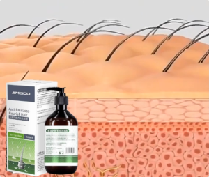 Ginger shampoo ginger extract shampoo hair fall shampoo  anti dandruff shampoo hair growth shampoo hair loss shampoo 500ml 生發水生姜洗发水 Promote hair growth and improve hair follicles