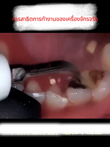 🌀31000ครั้ง/นาที🌀เครื่องขูดหินปูน ที่ขูดหินปูน เครื่องขูดหินปูนไฟฟ้า เครื่องขัดฟัน ที่ขูดหินปูฟัน เครื่องทำความสะอาดฟัน ล้างน้ำได้ 2ใน1 ขจัดหินปูนฟัน+แปรงฟัน IPX7