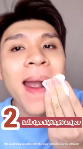 Kem Bôi Dưỡng Môi Hạt Fordyce Sumifun - Kem Dưỡng Môi Sumifun Cải Thiện Thâm Khô Môi Cứu Tinh Cho Đôi Môi Hạt Fordyce