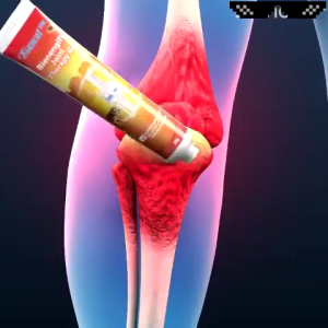 Bee Venom Joint Relief Gel Original Treatment Gel Joint and Bone Cream Supplement Treat Joint Knee Pain Toe Bone Pain Relief of joint pain lumbar spine cervical spine musculoskeletal pain professional treatment kneeshoulder neckwaist and leg gel