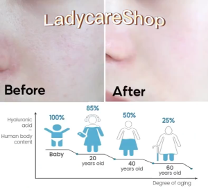 烟酰胺美白精华Nicotinamide Whitening essence Moisturizing Whitening Skin Whitening and Spot Removing 30ml Melanin Removing essence