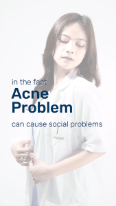 Acne Body Lotion Spotless Skin By Jevarine - Mengatasi Jerawat Badan Kulit Kusam dan Melembabkan Kulit