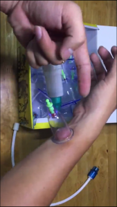 Bộ Giác Hơi 12 Cốc Không Dùng Lửa Giác Hơi 12 Ly Nhựa Trong Suốt Kèm Ống Bơm Hút Chân Không An Toàn Sức Khỏe