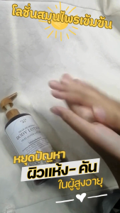 ผิวแห้ง คัน แตกลาย ในผู้สูงอายุและผู้ป่วยเบาหวาน โลชั่นสมุนไพรออแกนิค สูตรเข้มข้น เกรดส่งออก ผสานสารสกัดสมุนไพรพร้อมด้วยน้ำมันบำรุงผิวแบบเข้มข้น 300 มล. ขวดใหญ่ใช้นาน หอมมาก