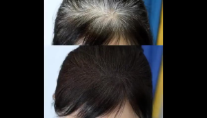 何首乌育发生发精华Polygonum multiflorum cultivation hair essence hair loss nourishing hair loss white hair follicle damage 100ml Polygonum multiflorum hair care spray