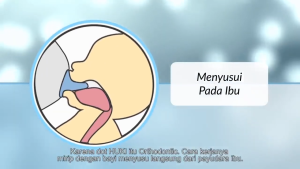Nipple HUKI Gepeng isi 3 ukuran S M L / Pentil Dot HUKI Gepeng isi 3