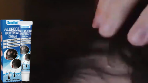 [READY STOCK]Obat Alopecia Areata penumbuh rambut cepat Obat penumbuh rambut botak pria dan wanita Obat Botak Koin Obat Rambut Pitak Obat Jamur Kulit Kepala Obat Penghilang Botak Koin