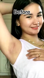 Sakura Gluta Underarm Whitening Cream Body Lotion Moisturizer for Armpit Body Dark Skin Pearl Capsule Moisturizing Essence