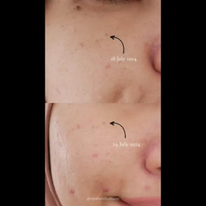 AMURA Bright Enhancing Serum: Mencerahkan Wajah & Mempercepat Regenerasi Kulit