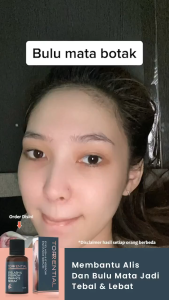 Torential Serum Penumbuh Pelentik Vitamin Bulu Mata dan Alis Torrential Eyebrow Eyelash