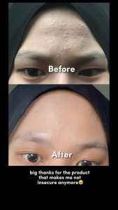 Glad2Glow Centella Allantoin Soothing Moisturizer Gel 55g