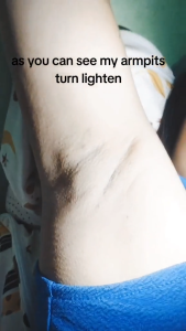 DUACARE Anti-Perspirant | Whitens Underarms & Prevents Body Odor