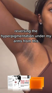 Kojic Acid Soap Kojic Acid Series Set Original Product Face Cream Body Lotion Facial Wash Whitening Anti Aging Acne Dark Spot