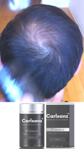 Carlxanz Hair Fiber For Hair Volume Thickness (Classic25g)