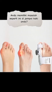 Adjustable Bunion Pelurus Jempol Kaki Ankle Protector Bunion Corrector Knob Hallux Valgus Relie