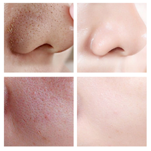 OEDO Mặt nạ vàng trị mụn đầu đen loại kiểm soát dầu thu nhỏ lỗ chân lông kem làm sạch sâu lỗ chân lông bụi bẩn chăm sóc da mặt 40g