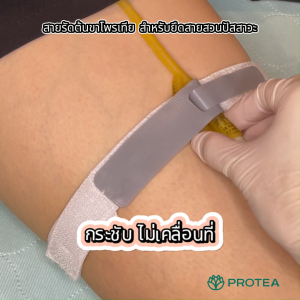 สายรัดต้นขาโพรเทีย สำหรับยึดสายสวนปัสสาวะ (แพ็ค 2 ชิ้น)