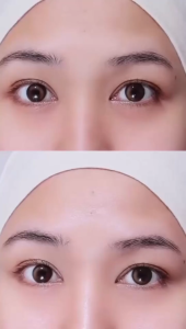 Emina Glo Rad Eye Wake Up Roller - Eye Serum Anti Mata Panda Mencerahkan Menyegarkan Memudarkan Tekstur & Garis Halus Glorad