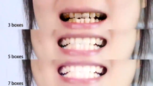 [BPOM] BREYLEE Teeth Whitening Powder - Mencerahkan & Membersihkan Gigi Perawatan Mulut (30 gr)