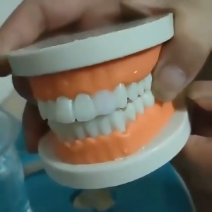 Penambal Gigi Berlubang Dengan Isi 30ml Lem Gigi Sementara Akan Membuat Dan Celah Gigi Akan Membuat Senyum Lebih Terlihat Sempurna Penambal Gigi Berlubang