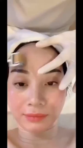 Cây Lăn Kim | Kim lăn tay | ZGTS | chính hãng dành cho spa thẫm mỹ viện