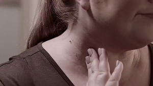 Mole removal cream professional traceless mole removal cream quality black mole flesh mole freckle cream no scars mole removal cream