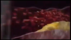 Habbats Garlive Habbatusauda Original - Obat Herbal Turunkan Kolestrol - Diabetes & Asam Urat