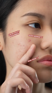 [BPOM] OMG Beauty Oh My Glow Panthenol + Ceramide Moisture Gel 30g | 7X Barrier Repair HA Ceramide Korea Niacinamide Hyaluronic Acid Bright Skin Fresh Cool Soft Gentle  Brightening Whitening Oil Control Bestseller Moisturizing Pelembap Muka Wajah