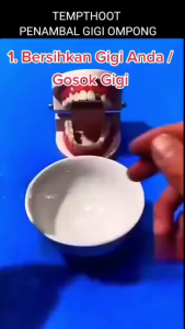 BUTIR TEMPTOOTH GIGI PALSU SEMENTARA UNTUK RESTORASI GIGI PATAH & RENGGANG