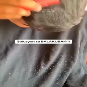 Original SADOER Coconut Oil Anti Dandruff Shampoo 500ml