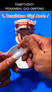 Temptooth Penambal Gigi Berlubang Ompong Patah Isi 300 Butir Temporary