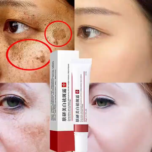 EBUG Anti Freckle Cream Black Spot Krim Flek Hitam Pelembab Wajah - VP030 Merah
