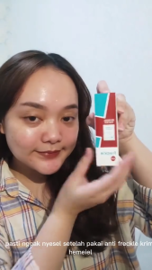 HEMEIEL - Anti Freckle & Frecle Remove Whiten Essence Cream 15ml - Cocok Untuk Semua Jenis Kulit Menghilangkan Bintik Hitam pada Wajah Meregenerasi Kulit Wajah Melembabkan Kulit Wajah Mencerahkan Kulit Wajah