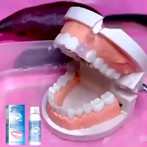 Butir Temptooth Gigi Palsu Sementara & Bahan Tambal Gigi Bolong